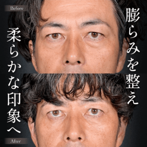 Mirrora式クマ取り