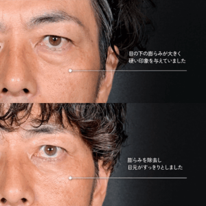 Mirrora式クマ取り