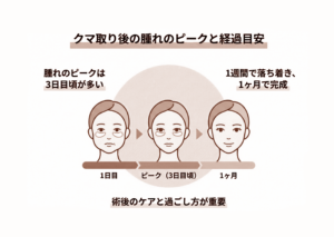 クマ取り後の腫れのピークはいつ？1日目〜1か月の経過目安