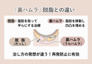 裏ハムラって結局なに？脱脂と違う“治し方の発想”を噛み砕いて説明
